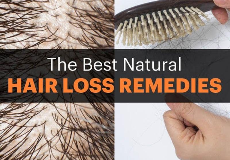 The Best Natural Hair Loss Remedies - Positive-Outlook-Grooming
